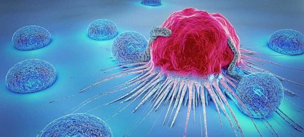 علت ابتلا به سرطان سینه چیست؟