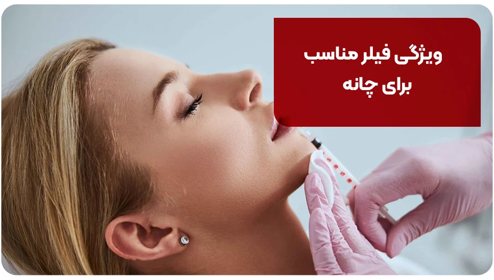 ویژگی&zwnj; فیلر مناسب برای چانه