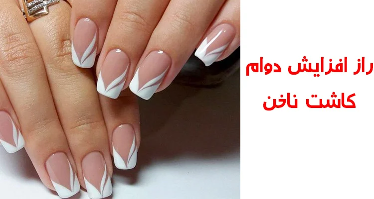 راز افزایش ماندگاری کاشت ناخن