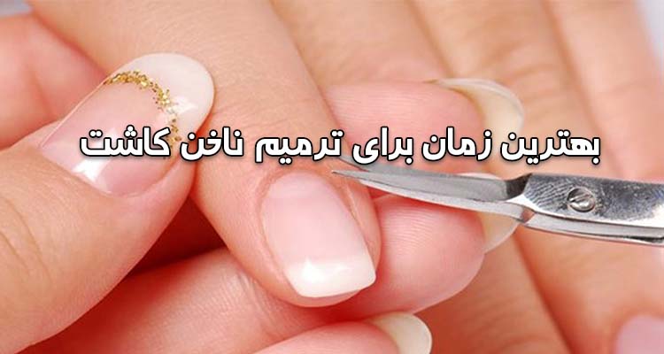 زمان ترمیم کاشت ناخن